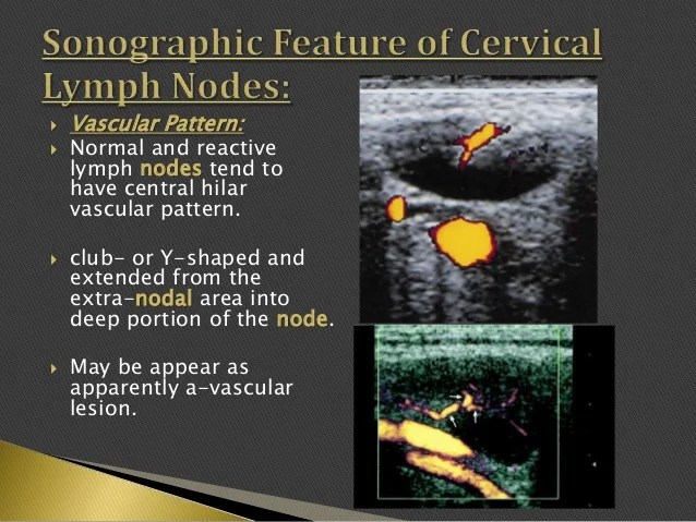 Imaging of enlarged lymph node