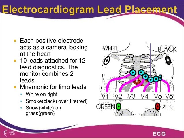 Interpreting ecg