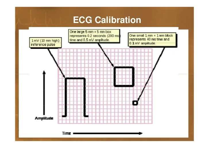 Basics of ECG