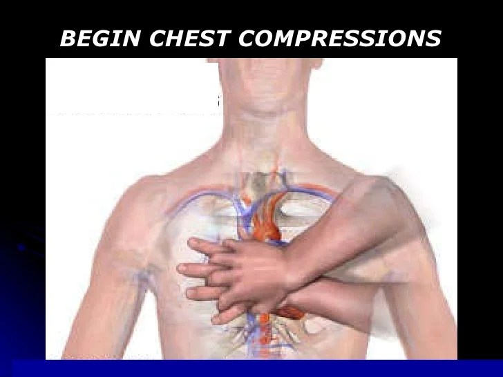 CPR