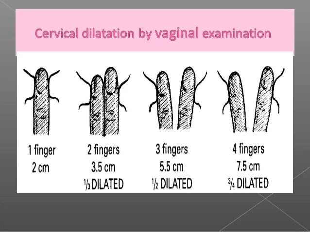 Normal and abnormal labor part 1