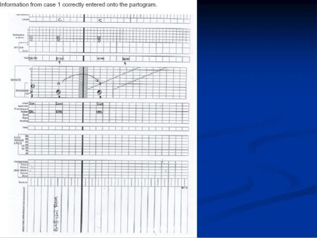 We did not find results for: THE PARTOGRAM