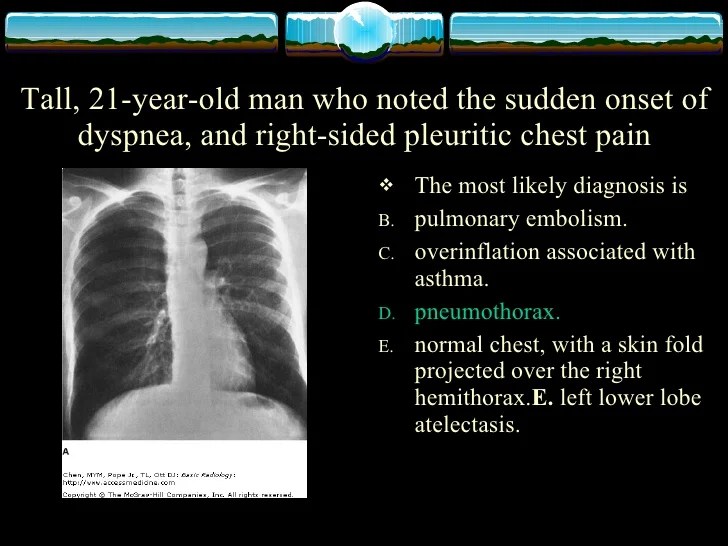 Physiology of Chest XRay