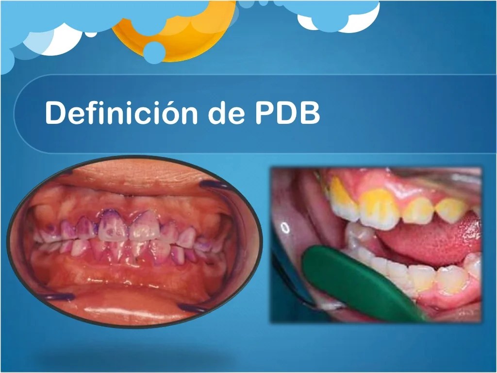 Placa dentobacteriana