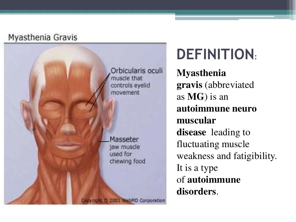 myasthenia gravis