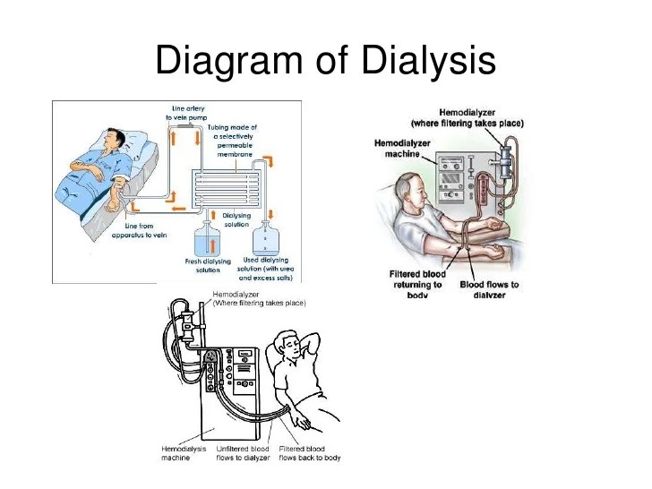 Presentation kidney