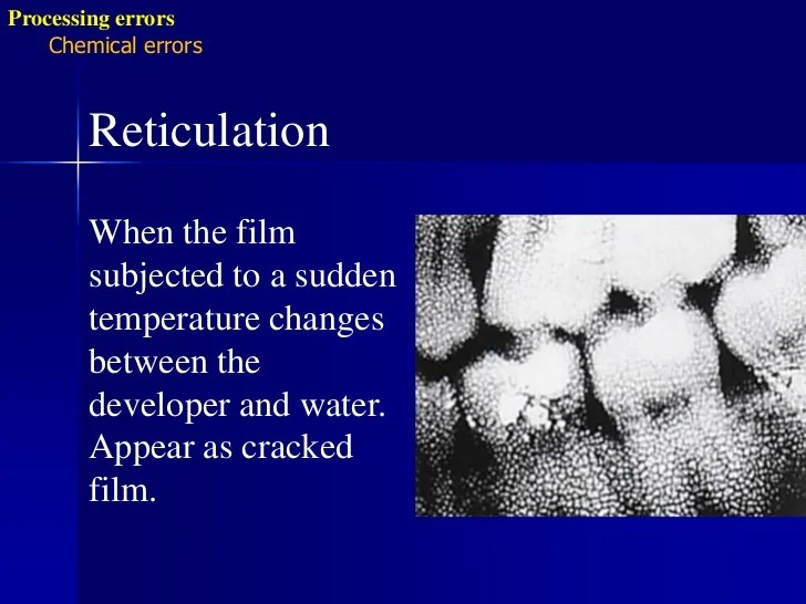 Radiographic errors and artifacts