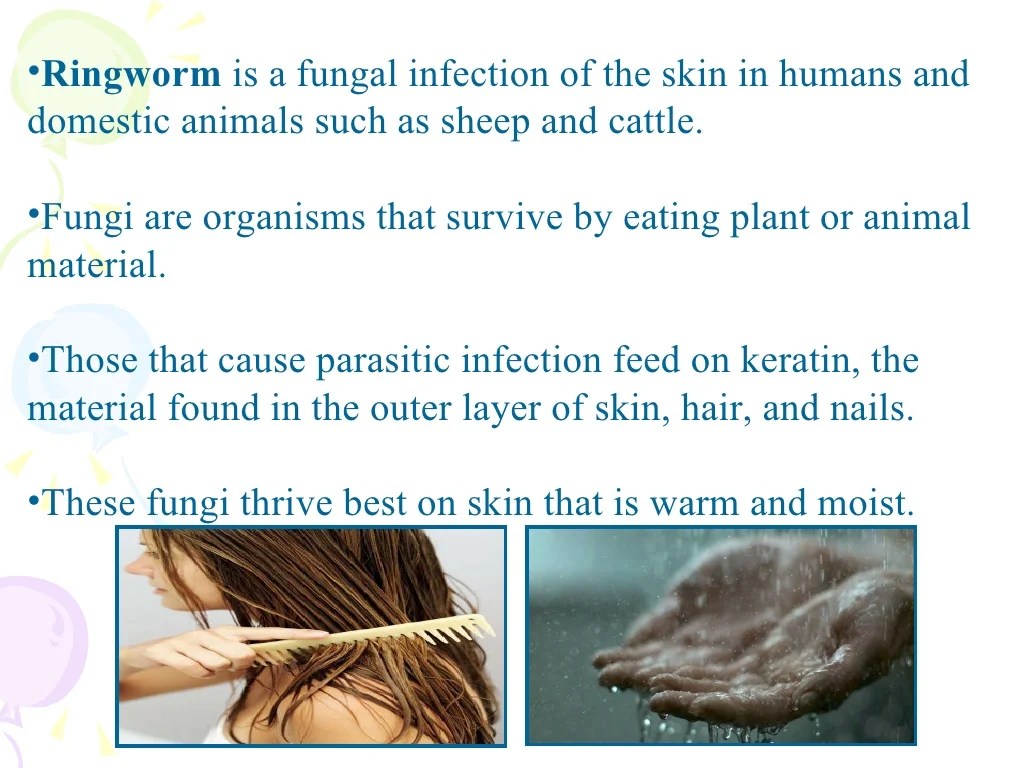 Famous Can Ringworm Be Spread Through A Swimming Pool 2022
