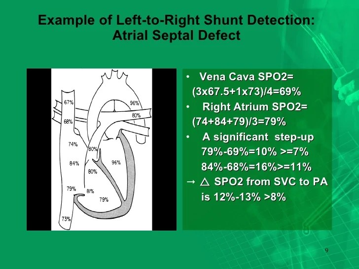 Shunt Detection And Quantification