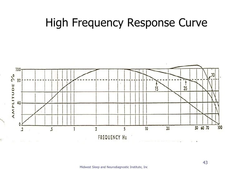 Signal processing and filters for reg review ms ni