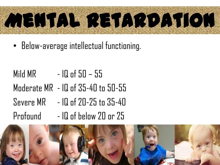 Language Development of Children with Down Syndrome
