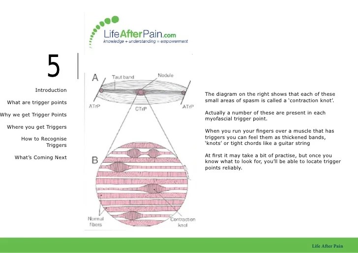 Trigger Point Manual