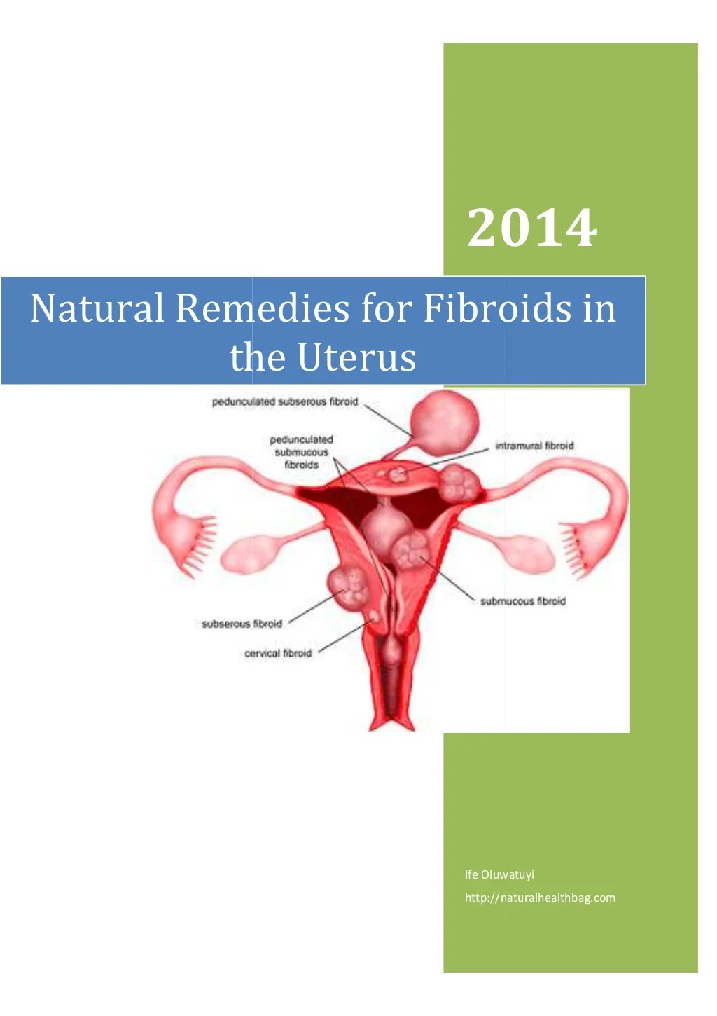How to Shrink Fibroids Naturally