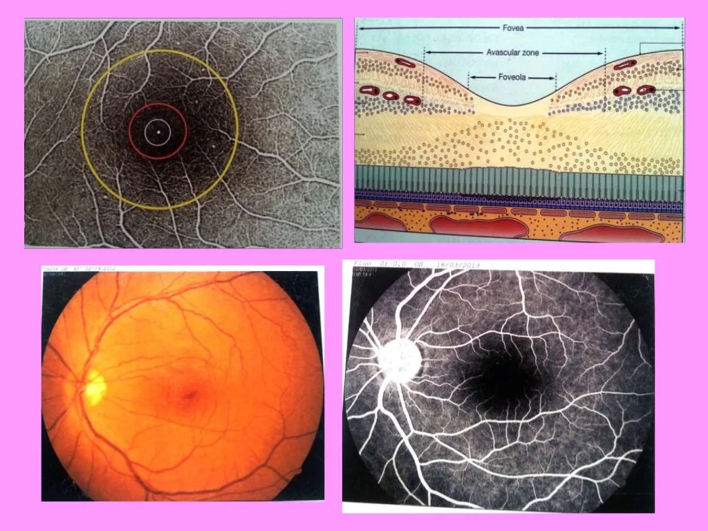 Visual field analysisinterpretation