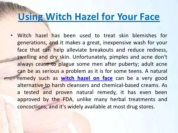 Using Witch hazel on face