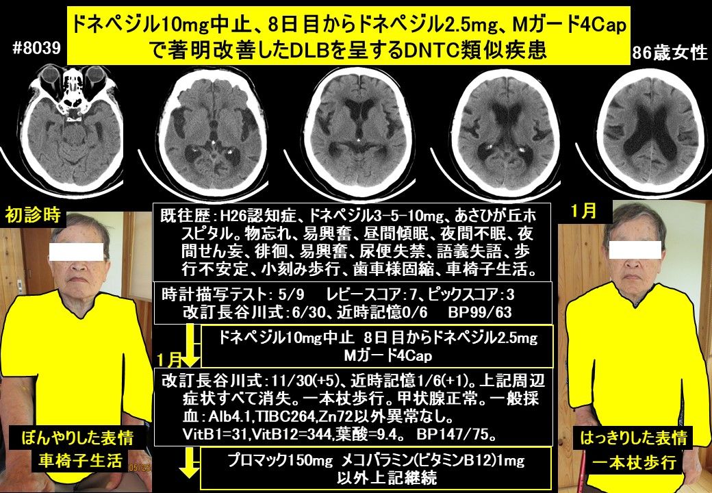 3ページ目の[ 長久手南クリニック認知症ブログ ] ドクターイワタの認知症・発達障害ブログ～認知症専門外来と