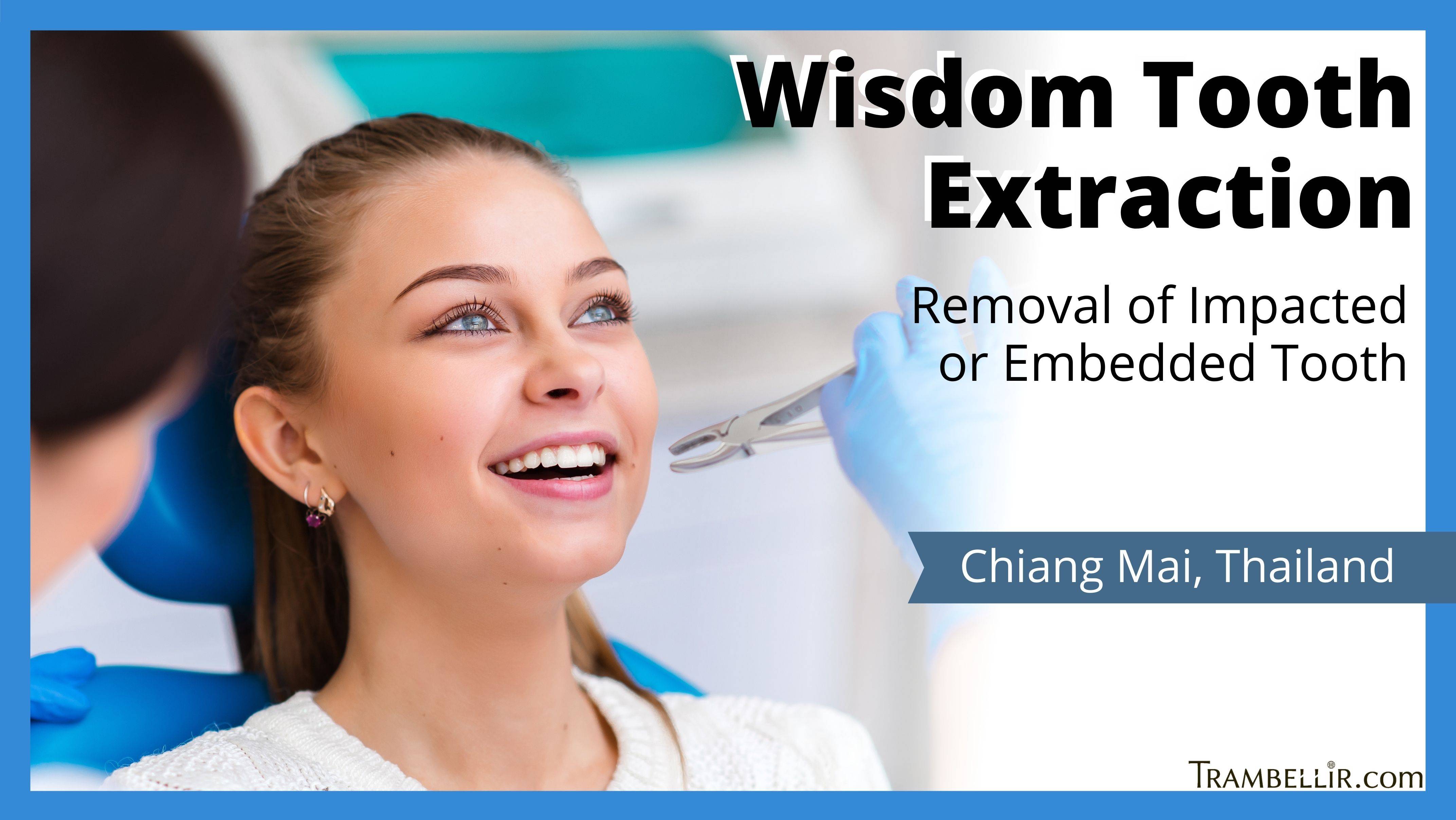 Wisdom Tooth Extraction (Removal of Impacted or Embedded Tooth