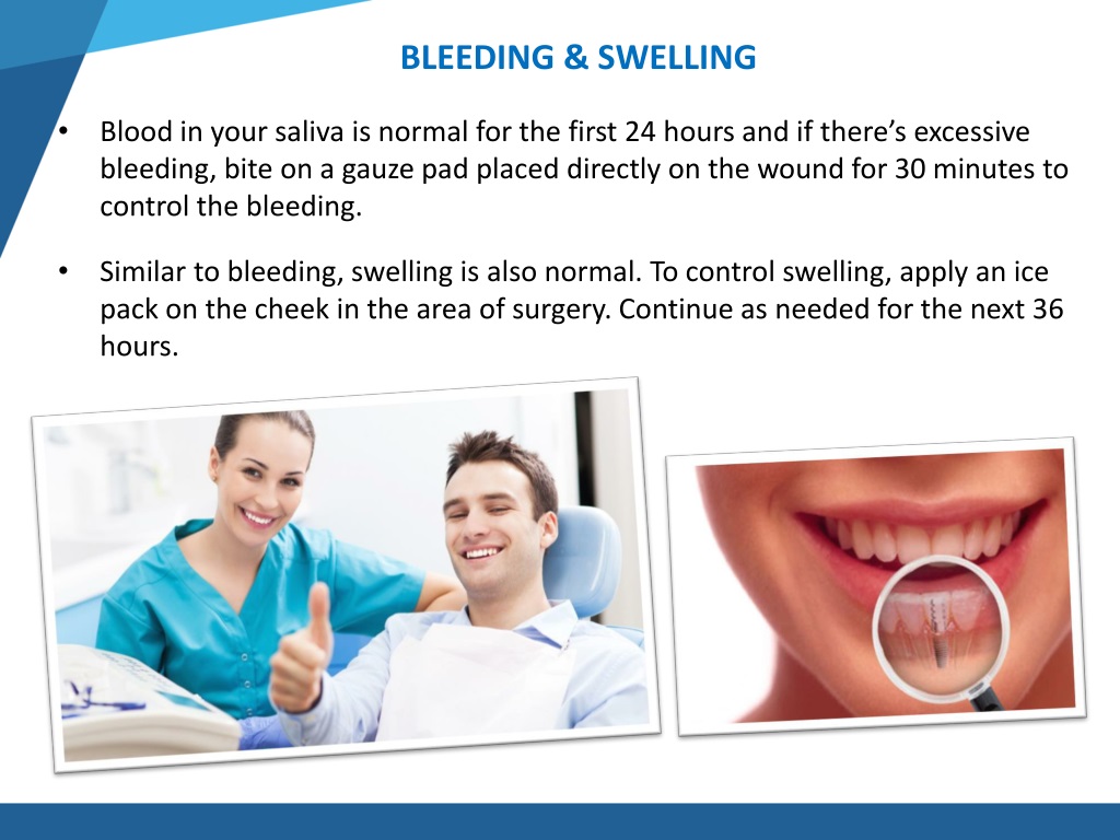 PPT What to do After Dental Implants Surgery in Vista, CA PowerPoint