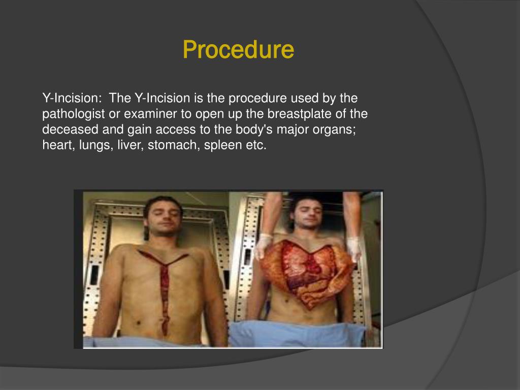 PPT AUTOPSIES PowerPoint Presentation, free download ID1555682(04)
