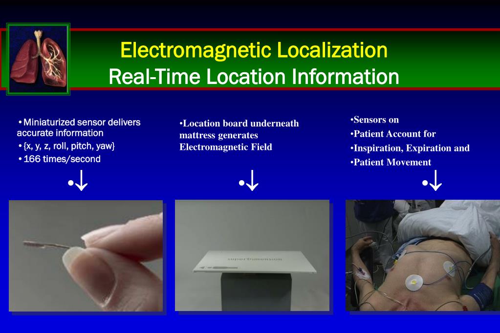 PPT Navigational Bronchoscopy versus CTguided biopsy