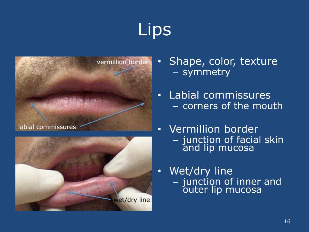 PPT David Reznik , DDS Oral Examinations for NonDental Clinicians