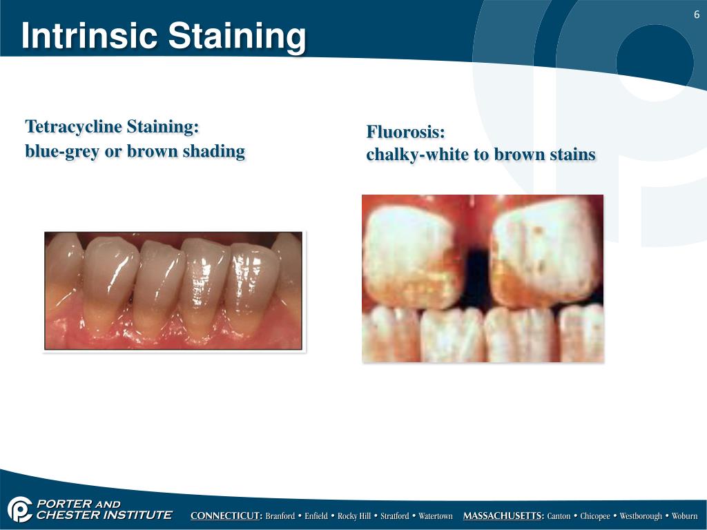 PPT Tooth Whitening PowerPoint Presentation, free download ID1602682