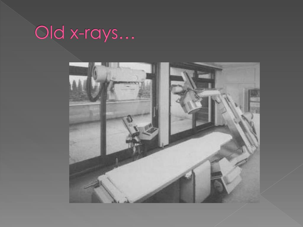 PPT Xray Photography PowerPoint Presentation, free download ID1606401