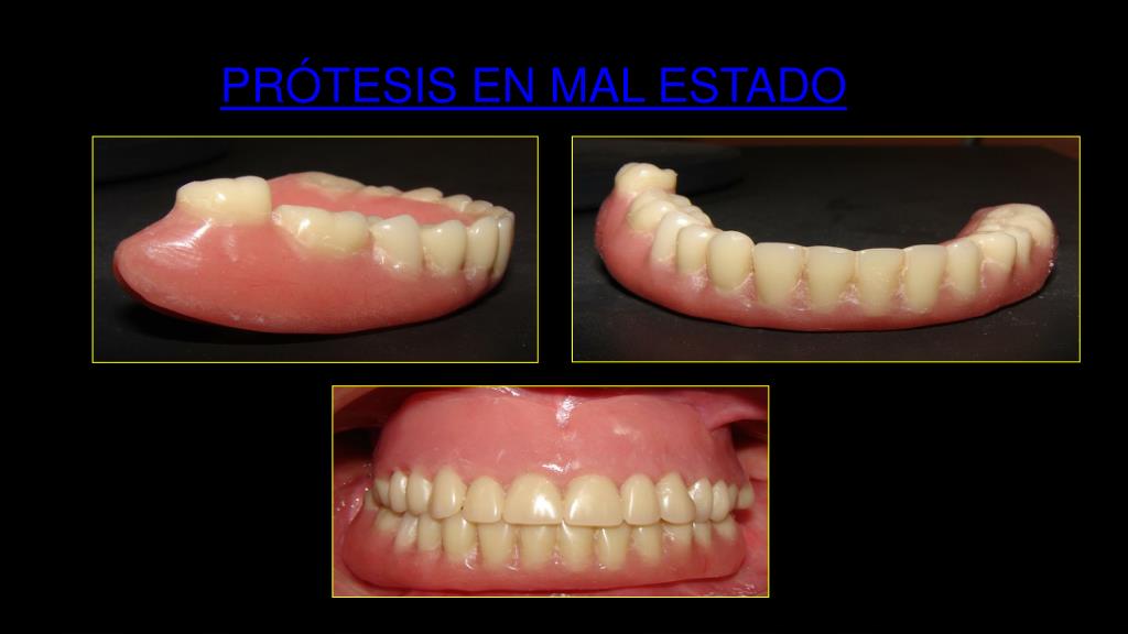 PPT PRESENTACION DR. RCANLLA PowerPoint Presentation