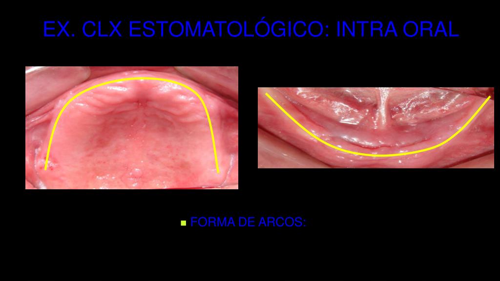 PPT PRESENTACION DR. RCANLLA PowerPoint Presentation