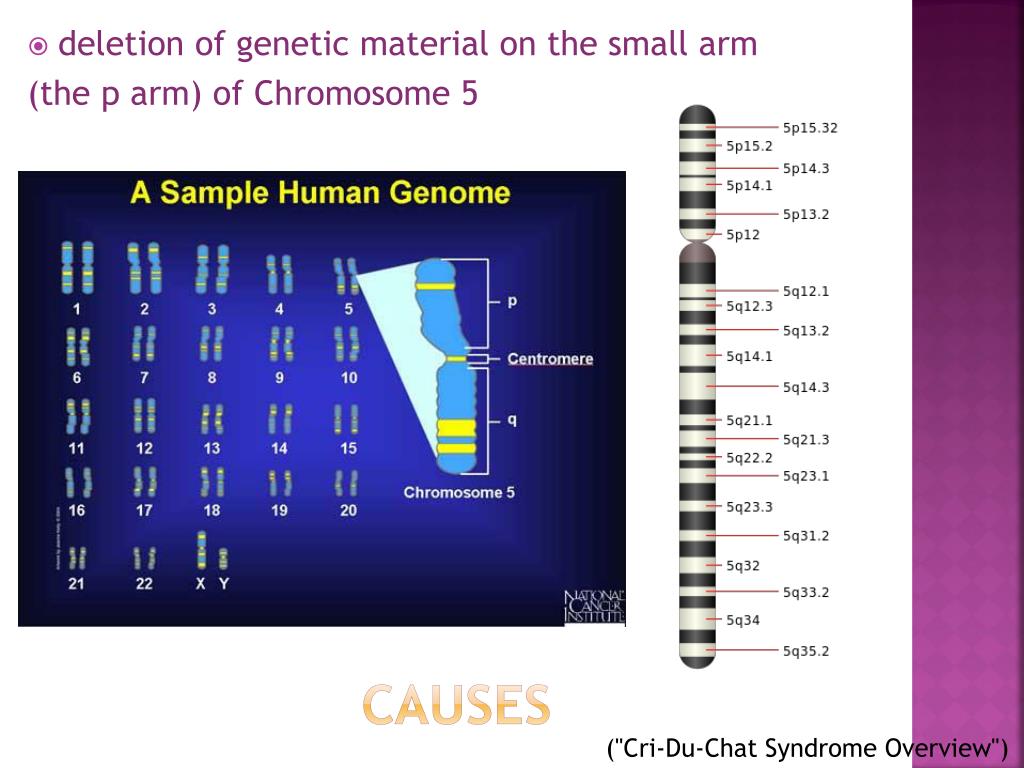 PPT CriDuChat Syndrome PowerPoint Presentation, free download ID
