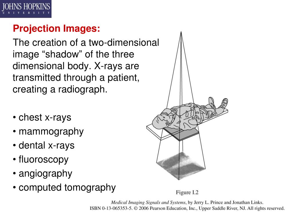 PPT - Projection Radiography (X-Ray) PowerPoint Presentation, free