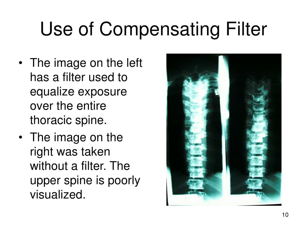 PPT Xray Filtration PowerPoint Presentation, free download ID1752246