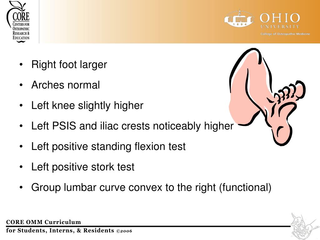 PPT Lower Extremity Osteopathic Approach to Patients with Postural