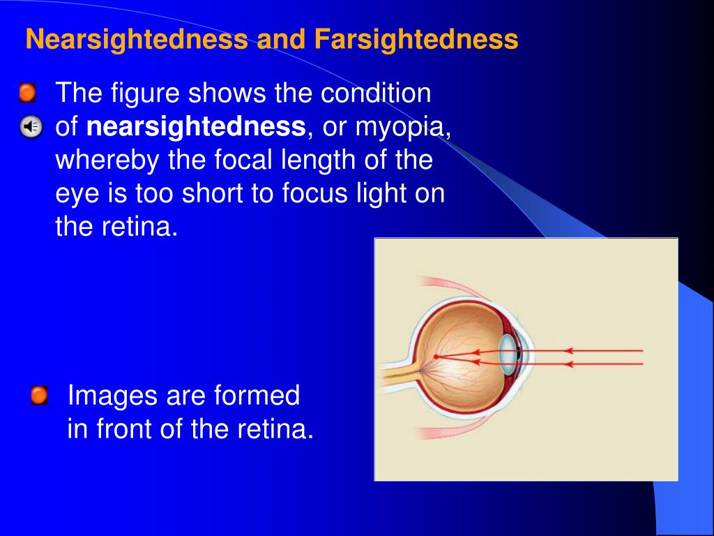 PPT Lenses in Eyes PowerPoint Presentation, free download ID1761660