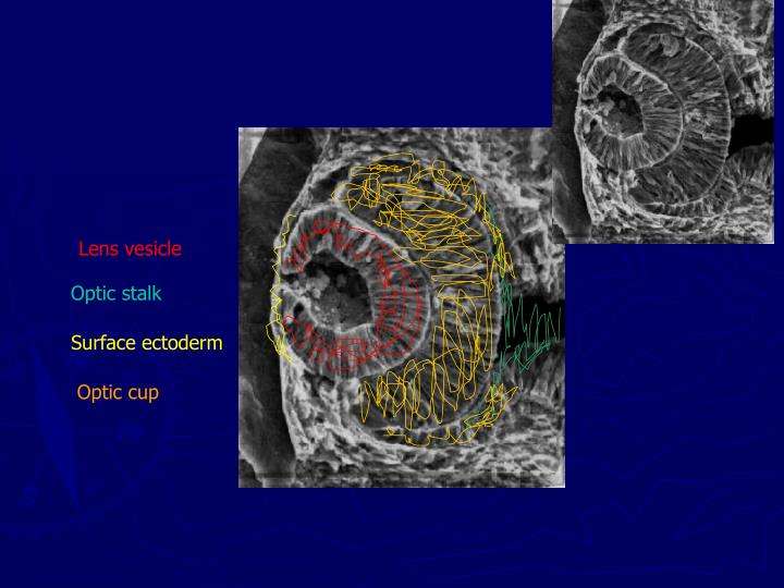 PPT Pediatric Optometry PowerPoint Presentation ID1761791