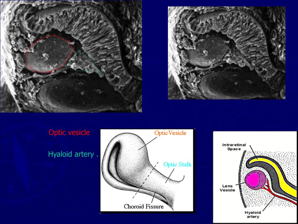 PPT Pediatric Optometry PowerPoint Presentation, free download ID