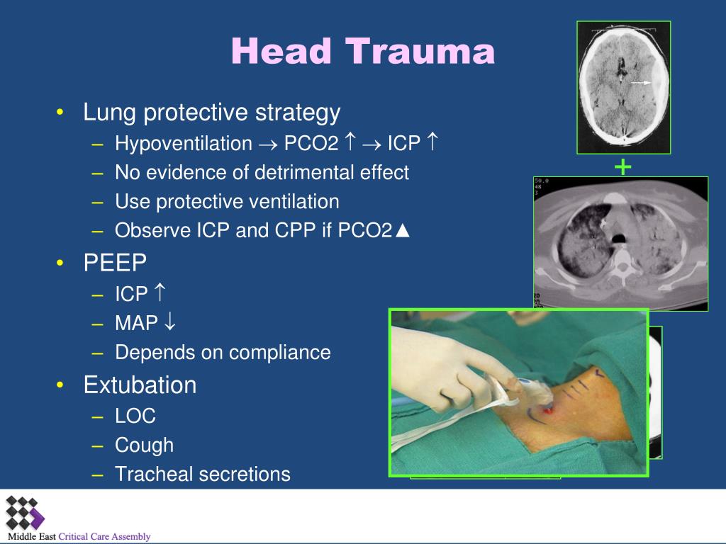 PPT Mechanical Ventilation in Special Conditions
