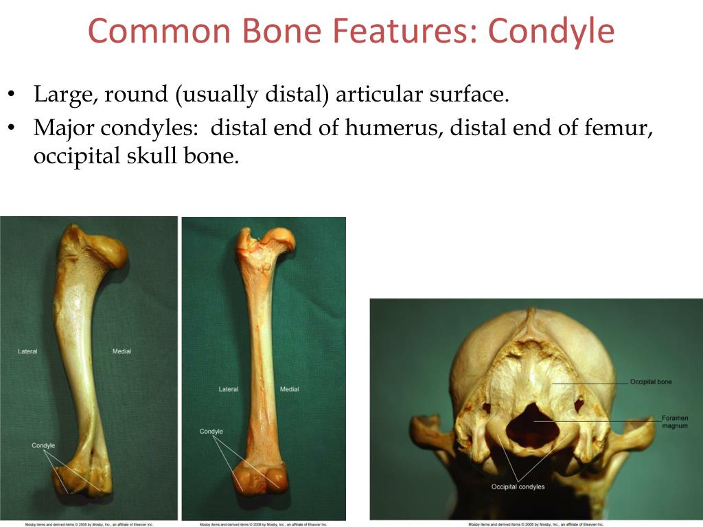 PPT Common Bone Features PowerPoint Presentation, free download ID