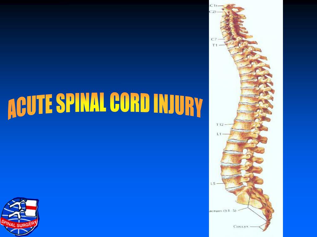 PPT ACUTE SPINAL CORD INJURY PowerPoint Presentation, free download