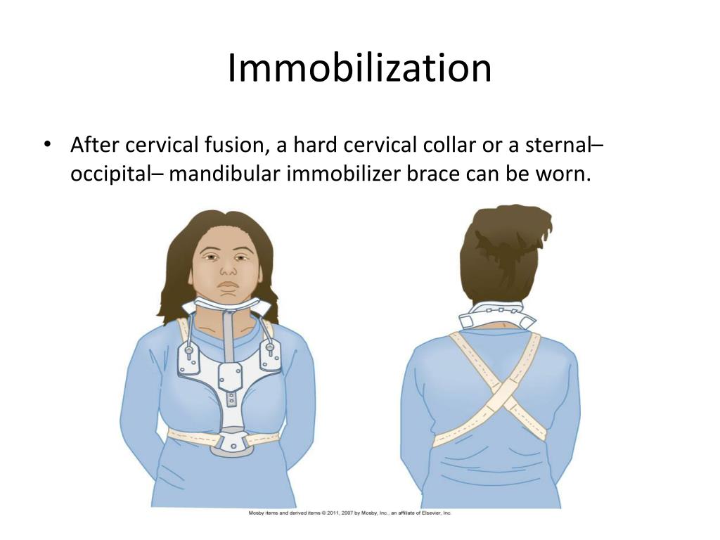 PPT Peripheral and Spinal Cord Problems PowerPoint