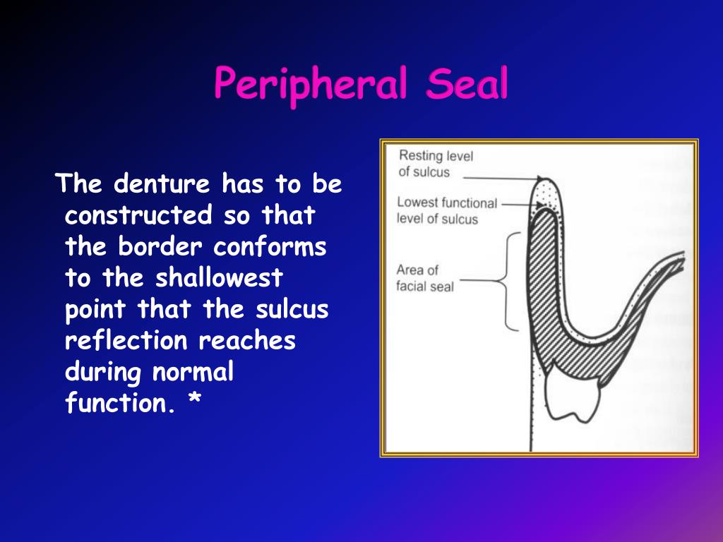 PPT Retention, Stability & Support PowerPoint Presentation, free