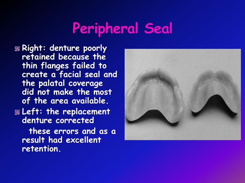 PPT Retention, Stability & Support PowerPoint Presentation, free