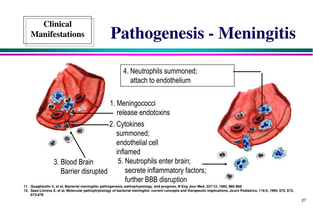 PPT Meningococcal Disease PowerPoint Presentation, free download ID