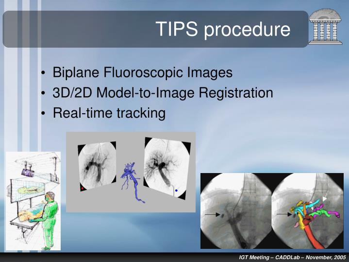 PPT - Image-Guided Surgery Applications PowerPoint Presentation - ID