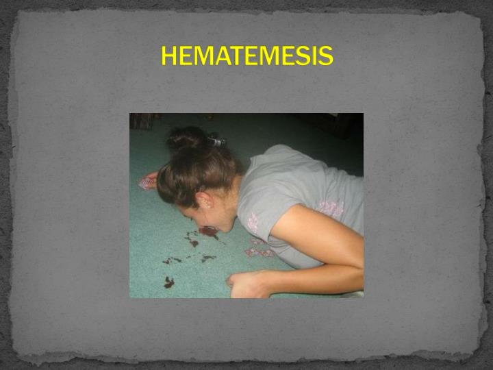 PPT GASTROINTESTINAL BLEEDING IN PEDIATRICS PowerPoint Presentation