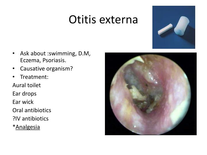 Otitis Externa Ear Drops Antibiotics