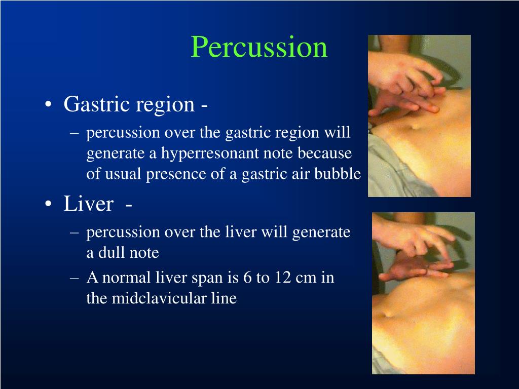 PPT ACUTE ABDOMINAL PAIN PowerPoint Presentation, free download ID