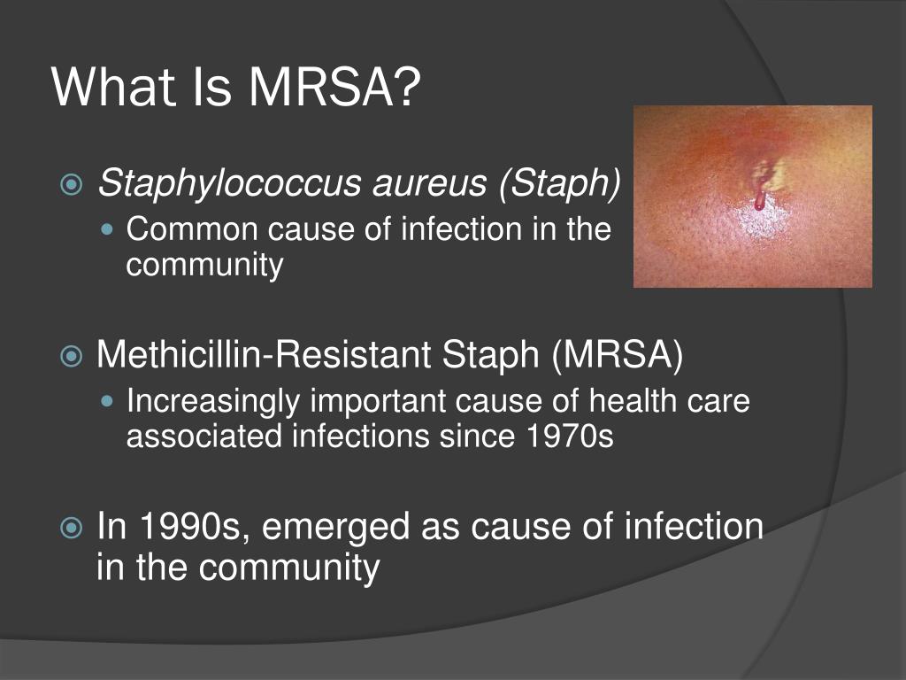 PPT MRSA PowerPoint Presentation, free download ID1816625