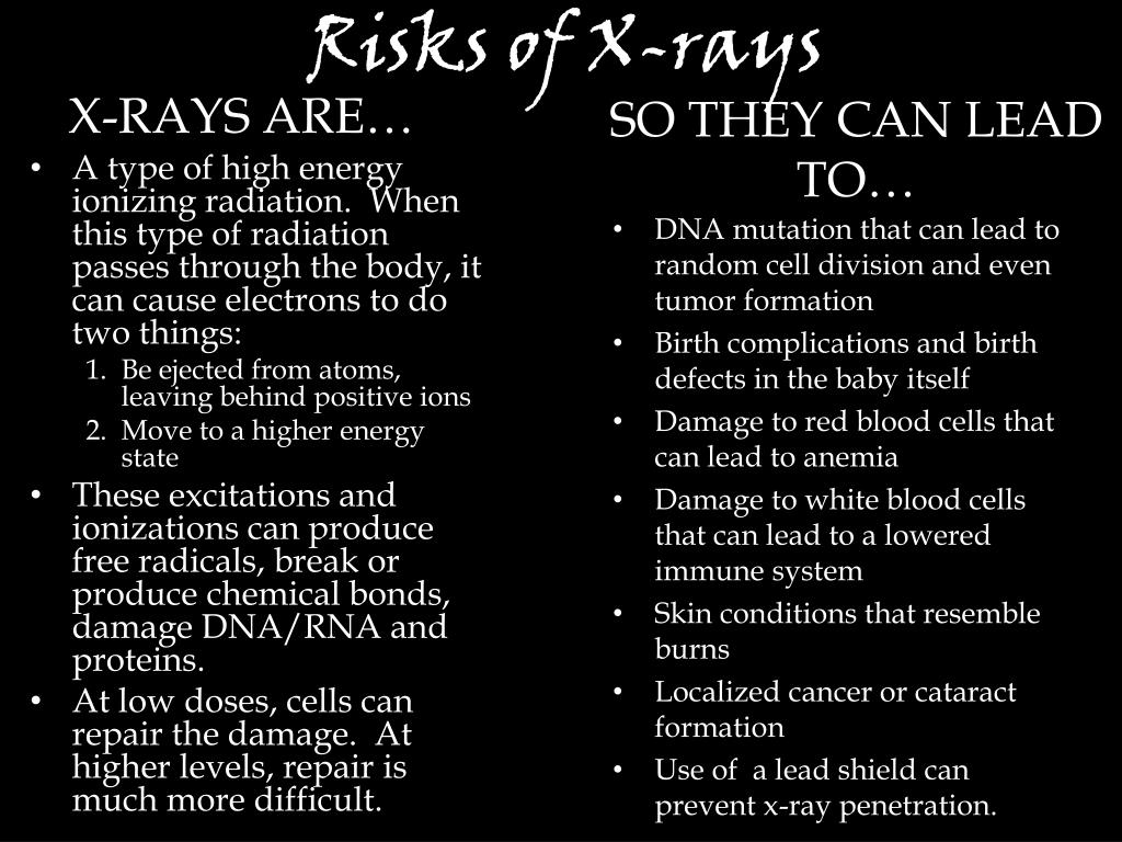 PPT XRAYS PowerPoint Presentation, free download ID1840778
