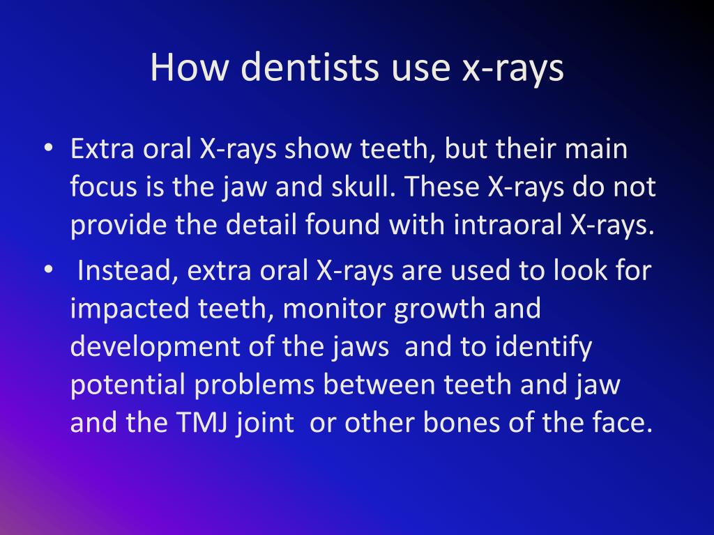 PPT XRays PowerPoint Presentation, free download ID1840805